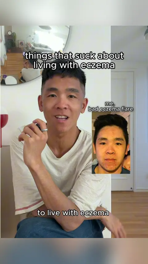 video cover: eczema can feel like one of the loneliest feelings